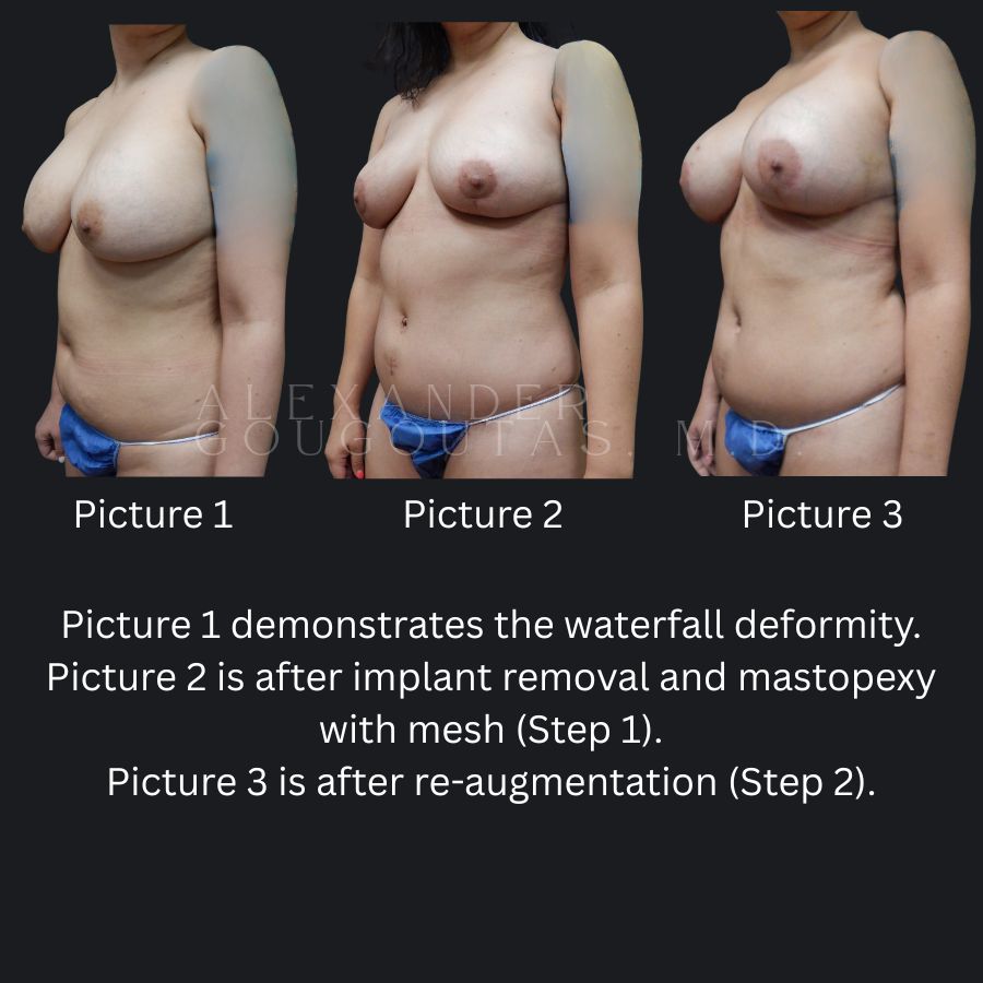 Actual Patient Results 2