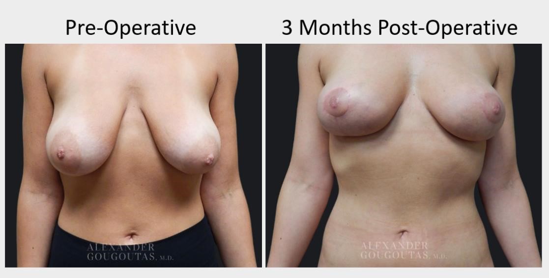 Pre-Operative Results
