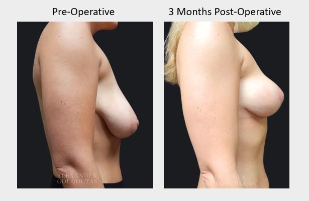 Pre-Operative Results