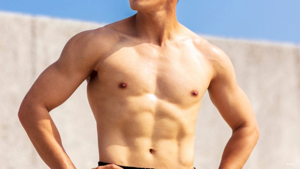 Alexander Gougoutas, M.D. Are Drains Necessary for Gynecomastia Surgery?