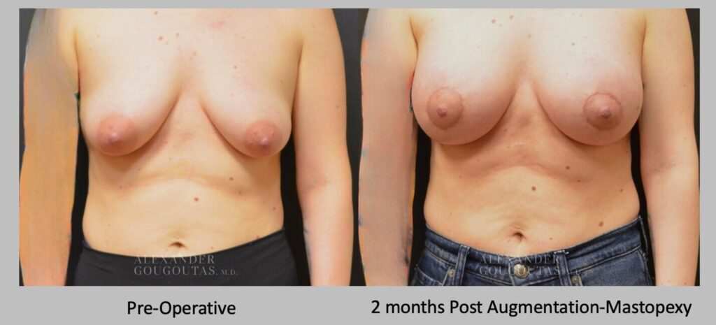 Patient Results