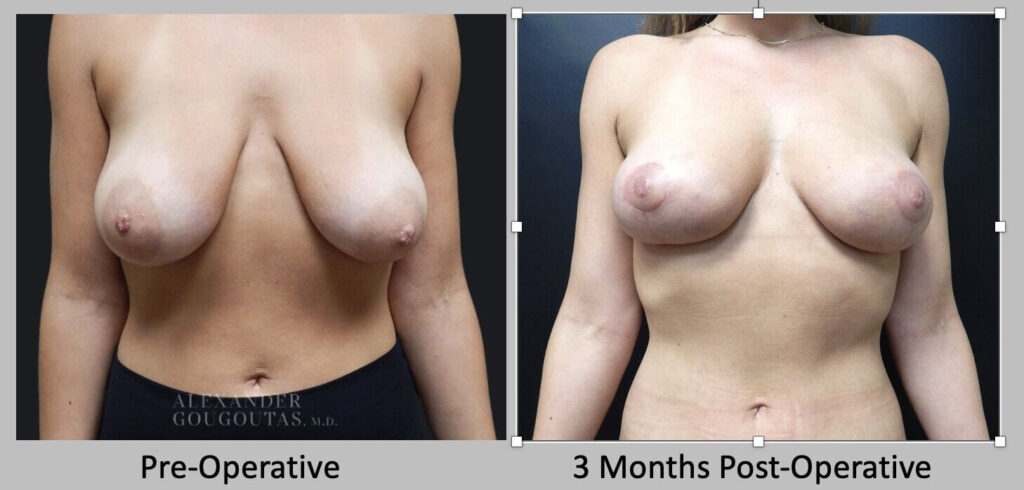 Patient Results