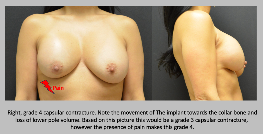 Before and After patient results 3