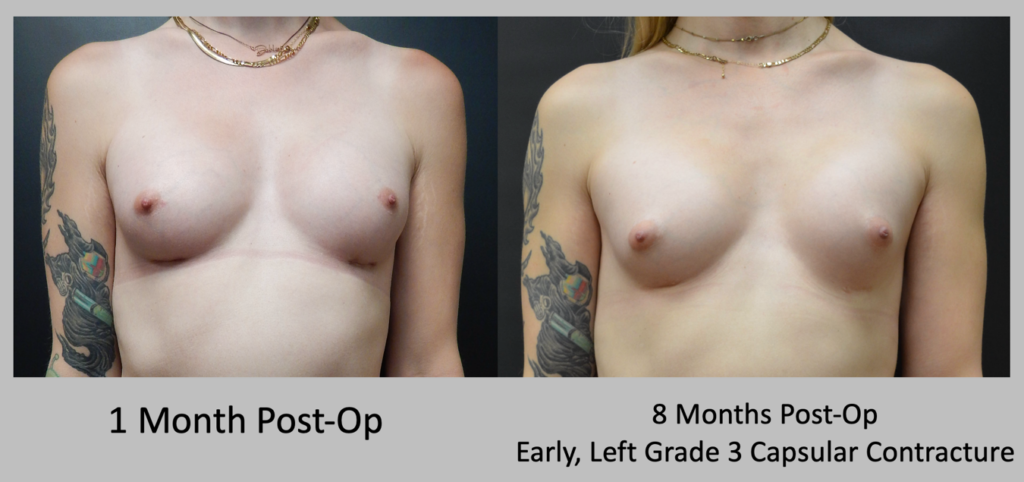 Before and After patient results 1