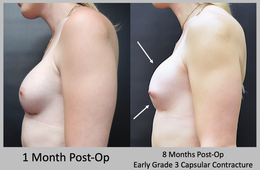 Before and After patient results 2