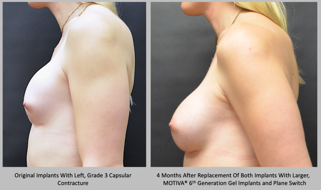 Before and After patient results 5